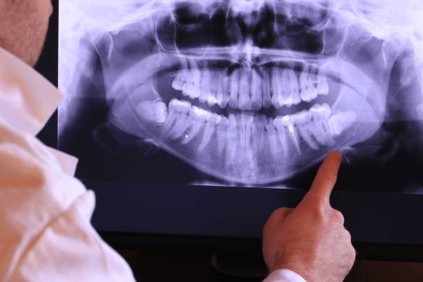 Best Emergency Treatment for Oral Infections in Shell Rock, IA