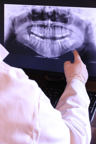 Best Knocked-Out Tooth (Avulsed Tooth) Treatment in Shell Rock, IA